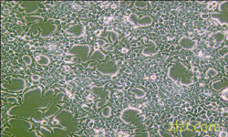 細胞鑒定CCD-195Sk人乳腺浸潤性導管癌旁皮膚細胞